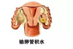 输卵管积水对女性健康有什么危害？